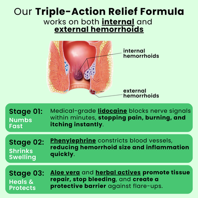 Advanced Hemorrhoid Relief Cream